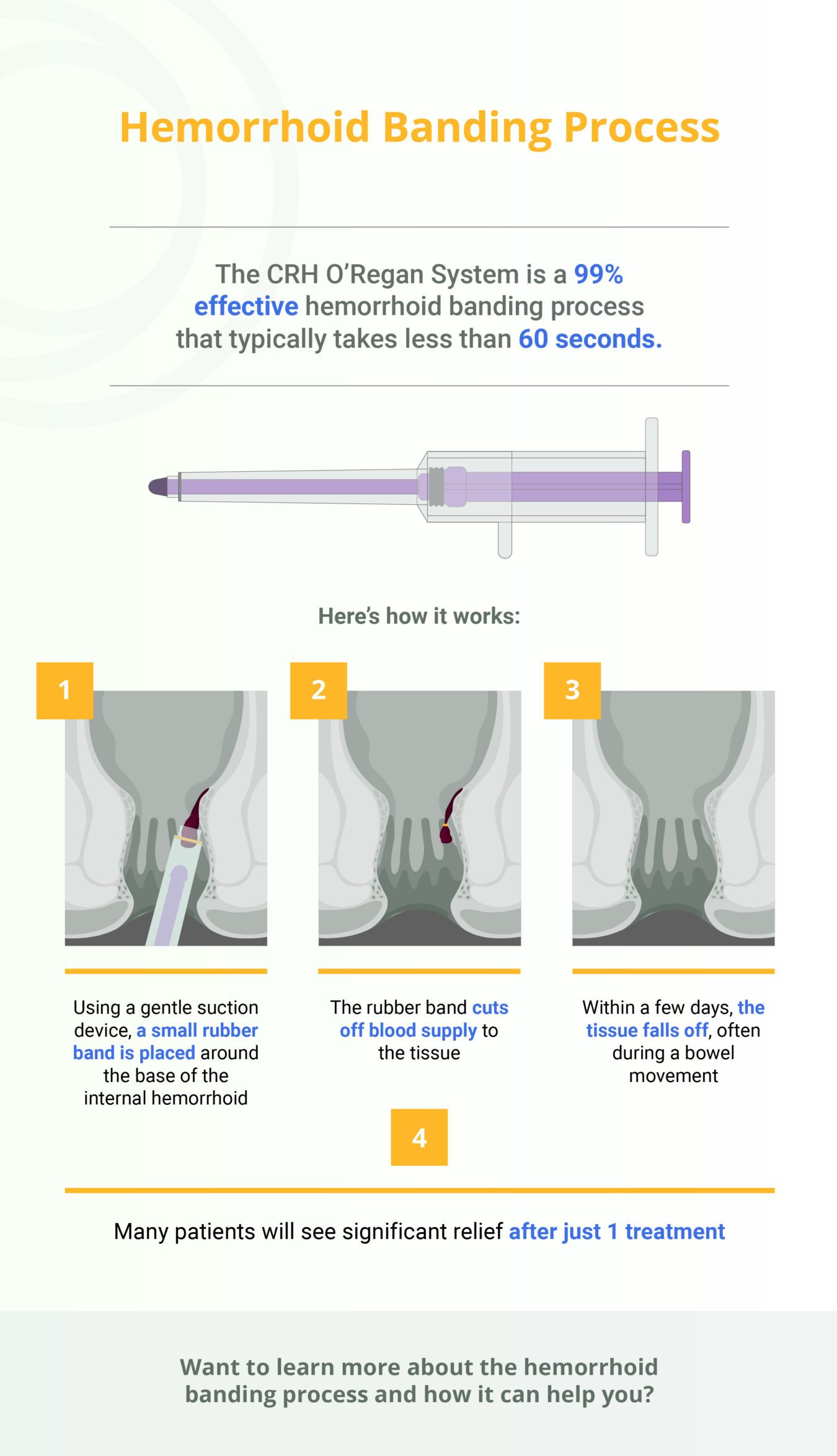 MG Hemorrhoid Banding Process REV2 Scaled 1 E1635969762397